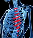 Lesión de Trabajo Hueso Fracturado Los Ángeles