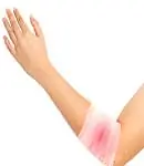 Los Ángeles-Brazo Lesionado en el Trabajo